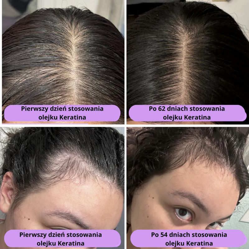 Naturalny Olejek na Porost Włosów