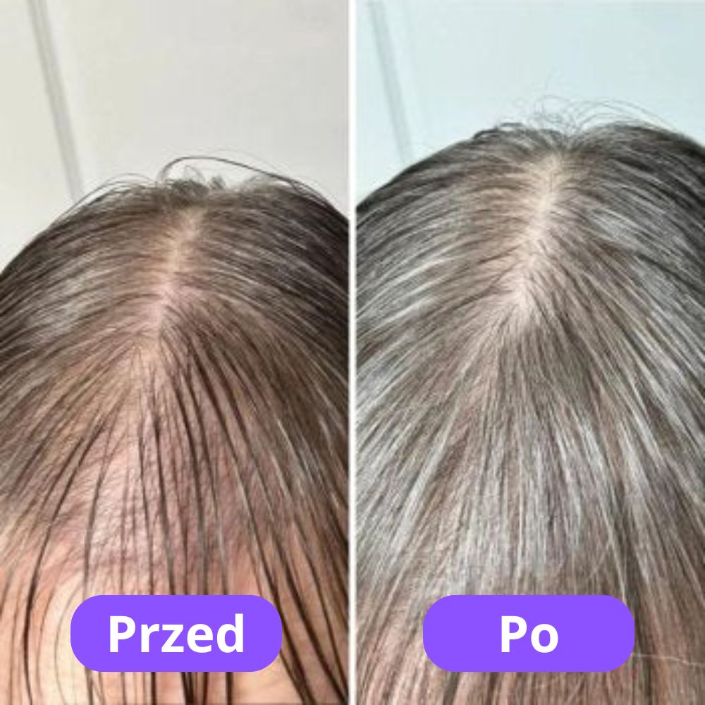 keratina-review-pl-8.jpg