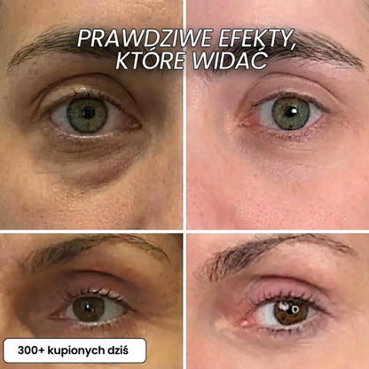 Stick Wypełniający Bio-Kolagen PDRN