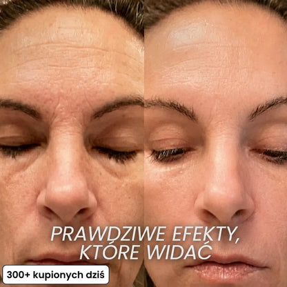 Stick Wypełniający Bio-Kolagen PDRN