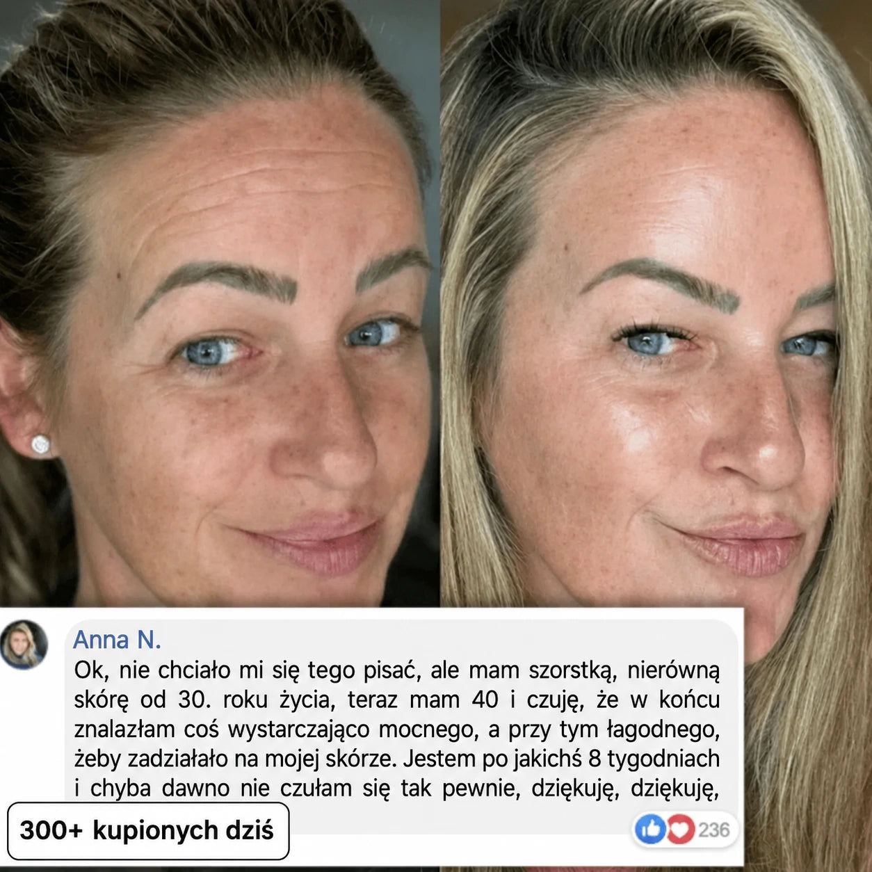 Stick Wypełniający Bio-Kolagen PDRN