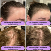 Naturalny Olejek na Porost Włosów